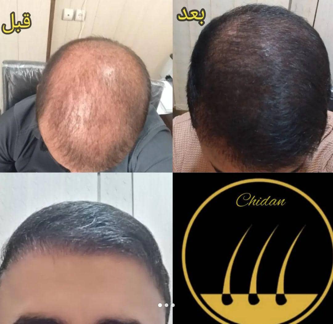 new image